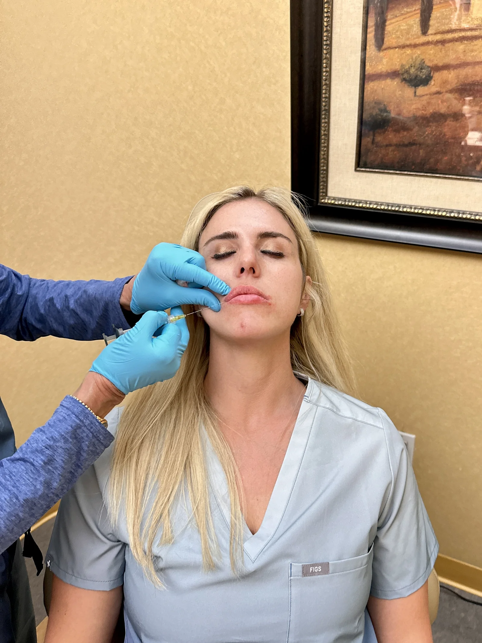Lip filler injection in progress at Reviv Med Spa